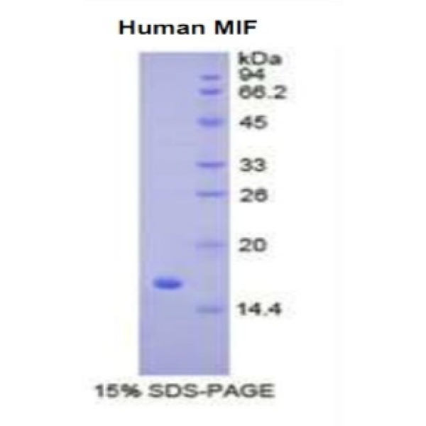 MIF蛋白；巨噬细胞移动抑制因子(MIF)重组蛋白