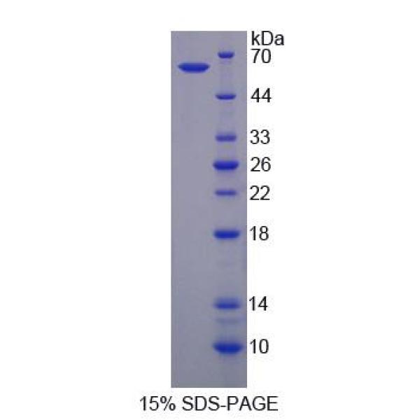 BCAR3蛋白；乳腺癌抗雌激素药物耐药性基因3(BCAR3)重组蛋白