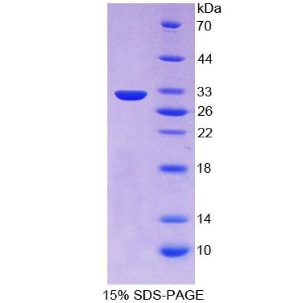 PCSK1蛋白；前蛋白转化酶枯草溶菌素1(PCSK1)重组蛋白