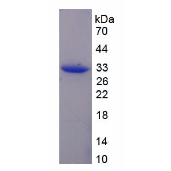 KIF1A蛋白；驱动蛋白家族成员1A(KIF1A)重组蛋白