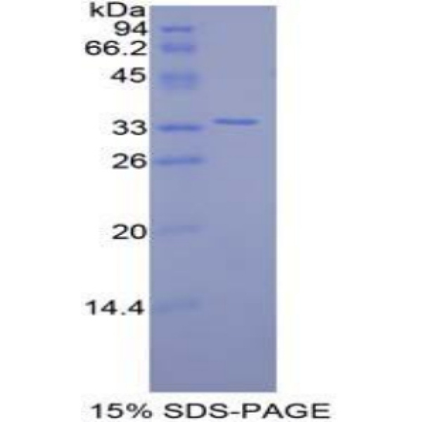 FZD10蛋白；卷曲同源物10(FZD10)重组蛋白