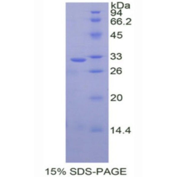 NRG1蛋白；神经调节素1(NRG1)重组蛋白