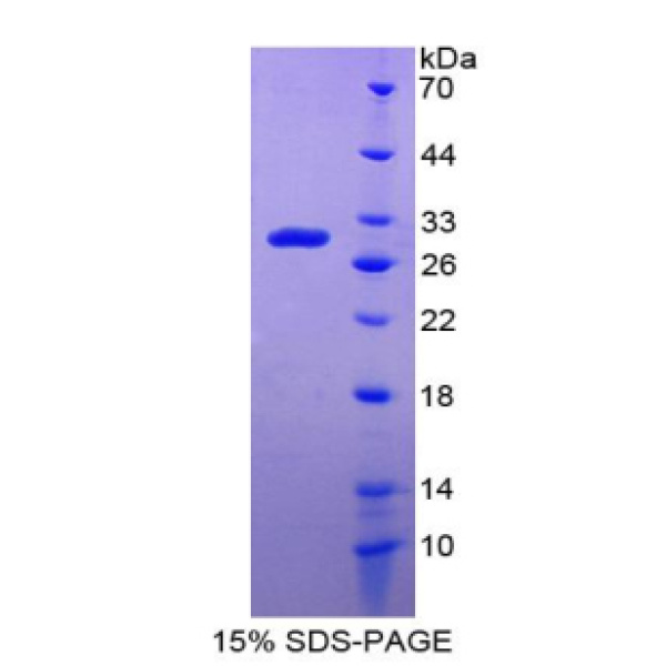 DDB2蛋白；损伤特异性DNA结合蛋白2(DDB2)重组蛋白