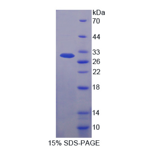 KARS蛋白；赖氨酸tRNA合成酶(KARS)重组蛋白