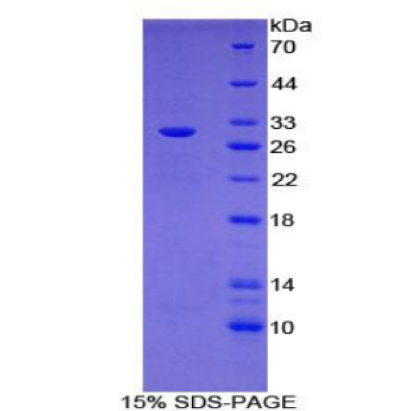 MSP蛋白；巨噬细胞刺激蛋白(MSP)重组蛋白