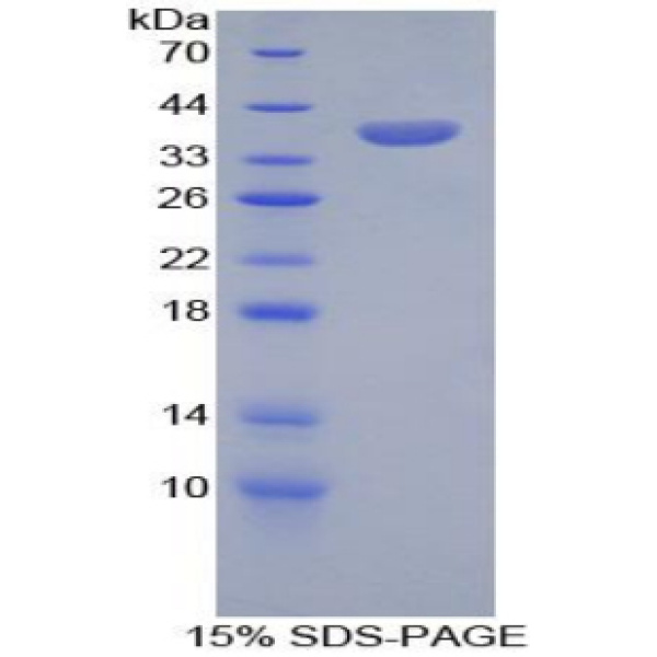 SPINK1蛋白；丝氨酸肽酶抑制因子Kazal型1(SPINK1)重组蛋白