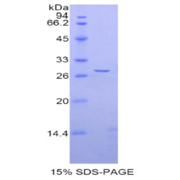 ADAM5蛋白；解整合素金属蛋白酶5(ADAM5)重组蛋白