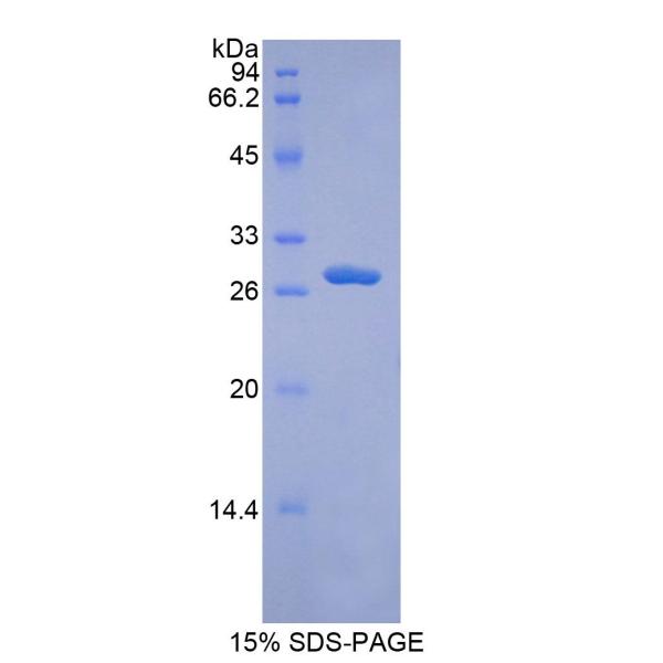 ADAM9蛋白；解整合素金属蛋白酶9(ADAM9)重组蛋白