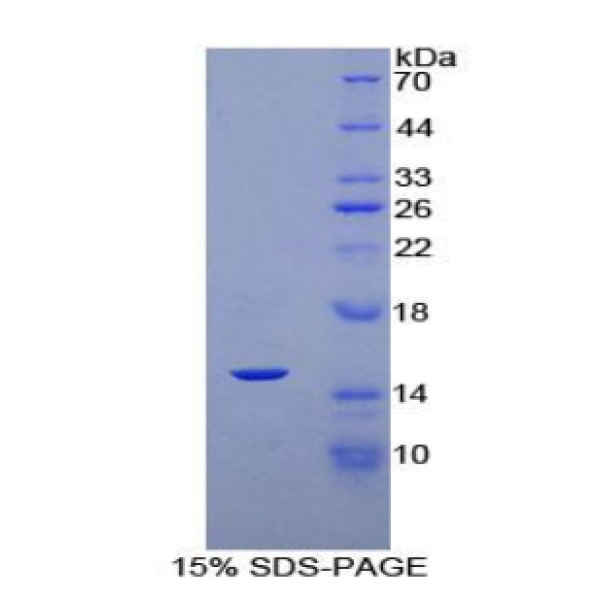 KLb蛋白；可罗索β(KLb)重组蛋白