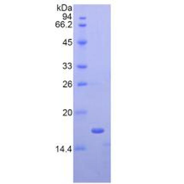 CHEM蛋白；趋化素(CHEM)重组蛋白