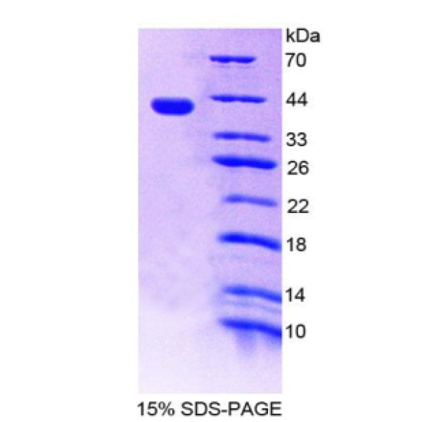 CENTa1蛋白；矢车菊苷α1(CENTa1)重组蛋白