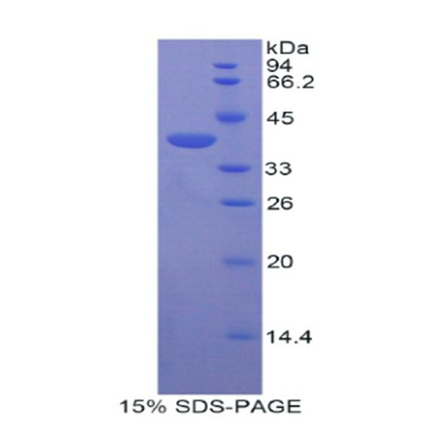 CENTa2蛋白；矢车菊苷α2(CENTa2)重组蛋白