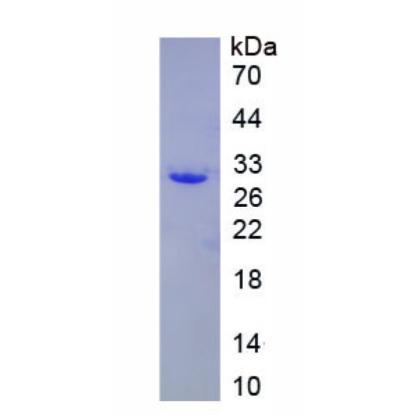 KPNa1蛋白；亲核素α1(KPNa1)重组蛋白