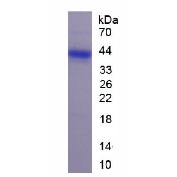 KL蛋白；可罗索(KL)重组蛋白