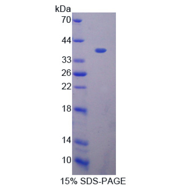 BCAS3蛋白；乳腺癌扩增序列3(BCAS3)重组蛋白