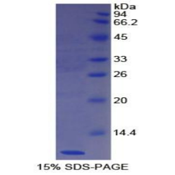 NES1蛋白；摄食抑制因子1(NES1)重组蛋白
