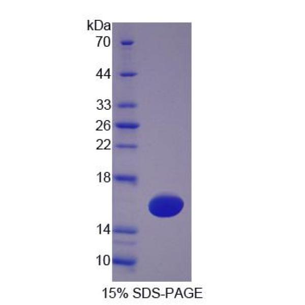 TSPAN1蛋白；四旋蛋白1(TSPAN1)重组蛋白