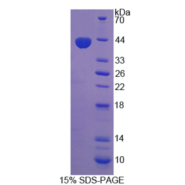 PCSK5蛋白；前蛋白转化酶枯草溶菌素5(PCSK5)重组蛋白