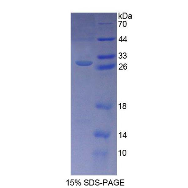 KPNa3蛋白；亲核素α3(KPNa3)重组蛋白
