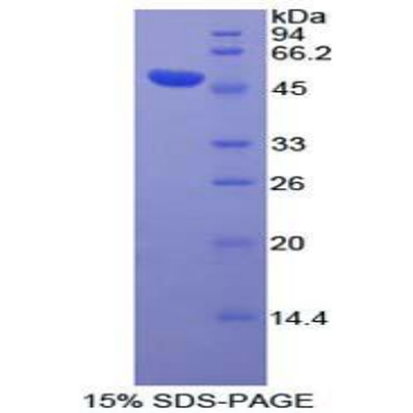 DVL3蛋白；蓬乱蛋白Dsh同源物3(DVL3)重组蛋白