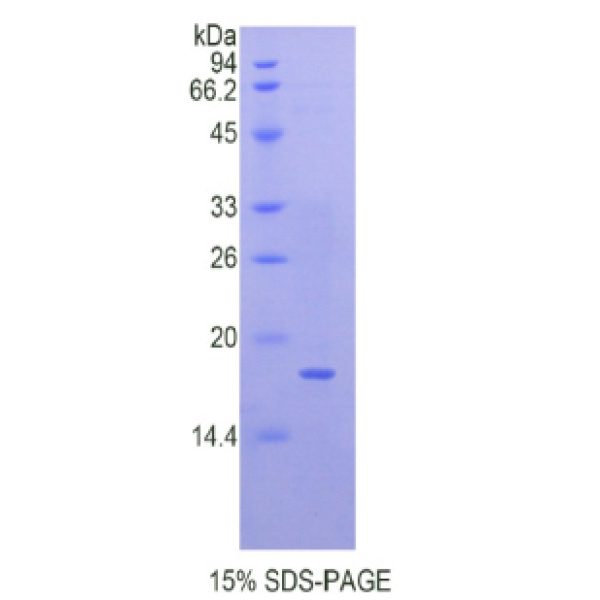 QSOX1蛋白；静止素Q6硫基氧化酶1(QSOX1)重组蛋白