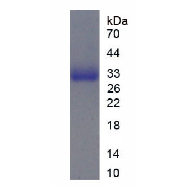 CD11a蛋白；淋巴细胞功能关联抗原1α(CD11a)重组蛋白