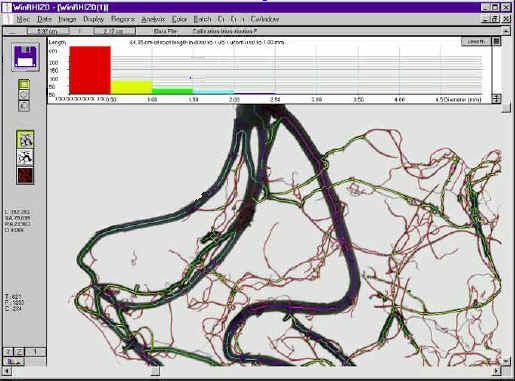 SpectraScan-R根系光谱扫描成像分析系统