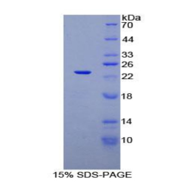 SIT1蛋白；信号阈值调节跨膜衔接因子1(SIT1)重组蛋白