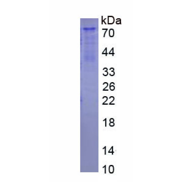 PI16蛋白；肽酶抑制因子16(PI16)重组蛋白