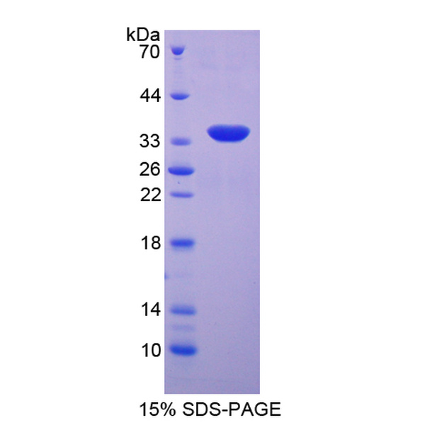 SGK2蛋白；血清/糖皮质激素调节激酶2(SGK2)重组蛋白