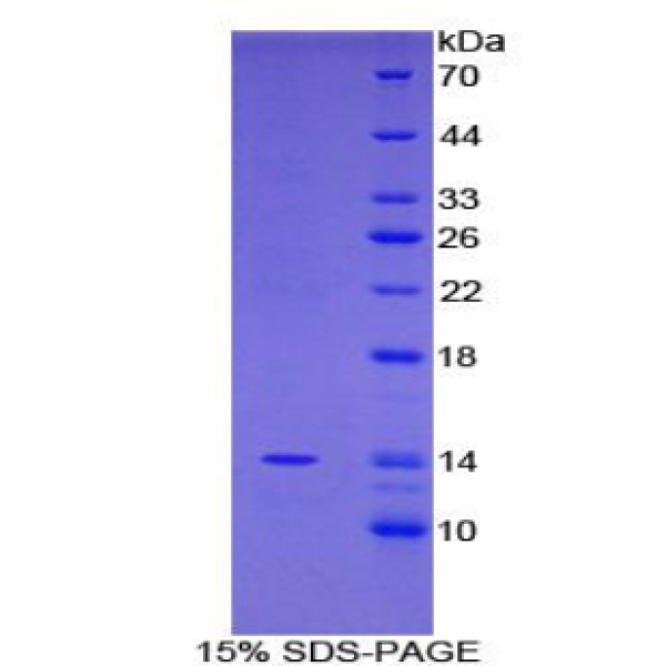 FAM19A2蛋白；序列相似家族19成员A2(FAM19A2)重组蛋白