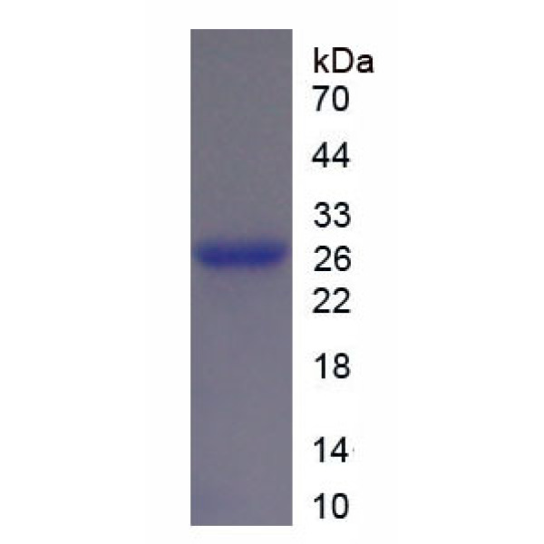TUBb1蛋白；微管蛋白β1(TUBb1)重组蛋白