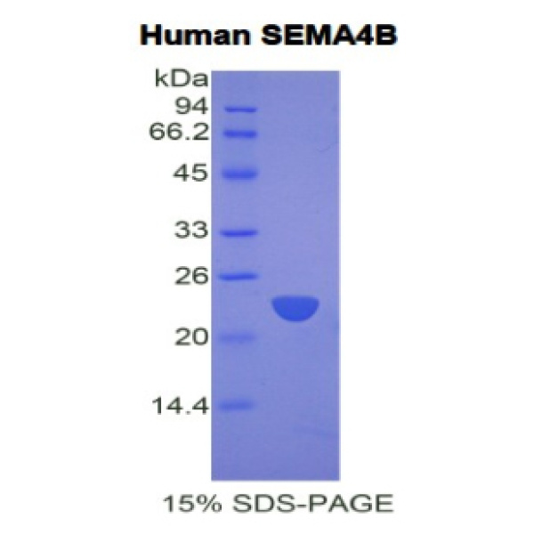 SEMA4B蛋白；信号素4B(SEMA4B)重组蛋白