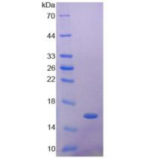 GLP1R蛋白；胰高血糖素样肽1受体(GLP1R)重组蛋白