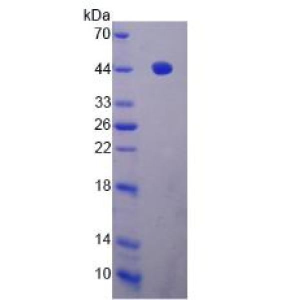 血小板反应蛋白解整合素金属肽酶19(ADAMTS19)重组蛋白