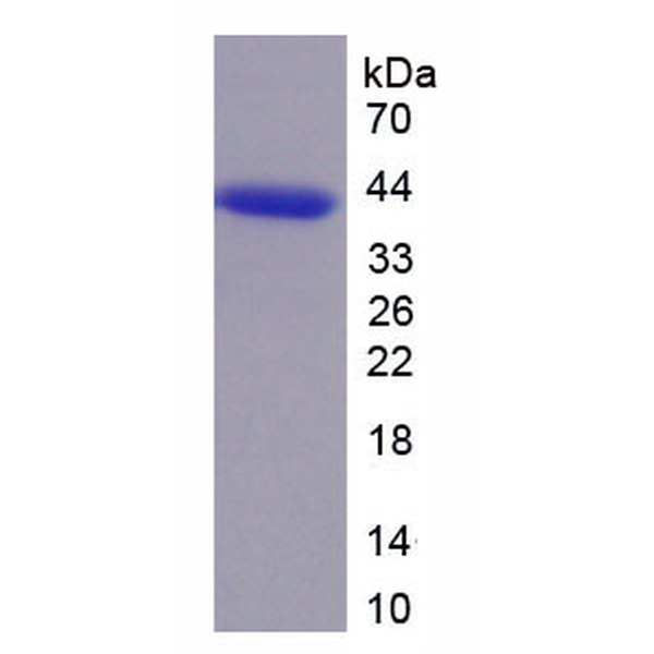 CDK6蛋白；周期素依赖性激酶6(CDK6)重组蛋白