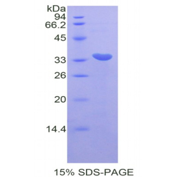 CDK7蛋白；周期素依赖性激酶7(CDK7)重组蛋白