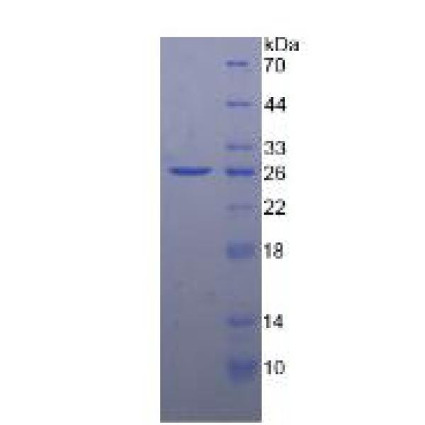 FCN1蛋白；纤维胶凝蛋白1(FCN1)重组蛋白