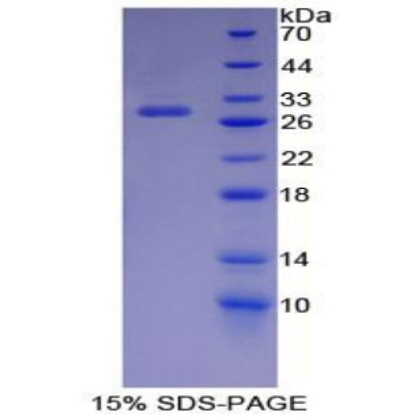 CDK9蛋白；周期素依赖性激酶9(CDK9)重组蛋白