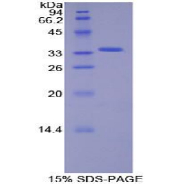 SIK2蛋白；盐诱导激酶2(SIK2)重组蛋白