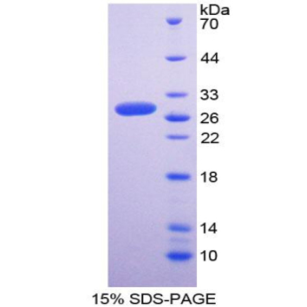 SOD4蛋白；铜伴侣超氧化物歧化酶(SOD4)重组蛋白