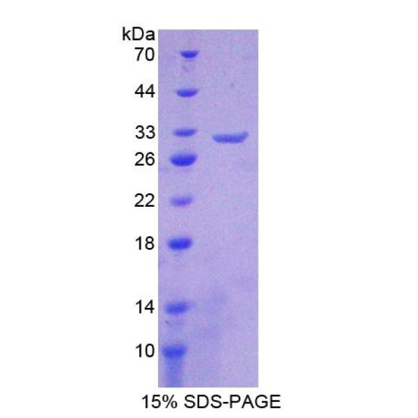 CHRNb2蛋白；烟碱型胆碱受体β2(CHRNb2)重组蛋白
