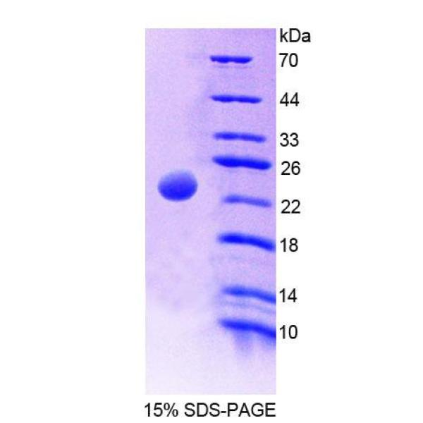 AK2蛋白；腺苷酸激酶2(AK2)重组蛋白