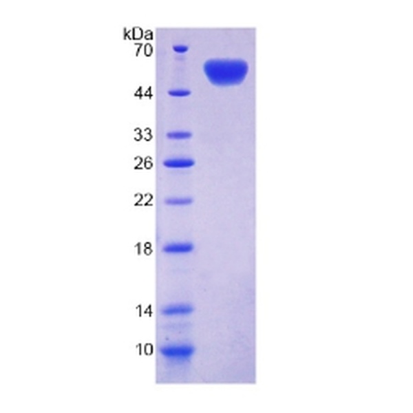 CDHOB蛋白；造骨细胞钙黏蛋白(CDHOB)重组蛋白