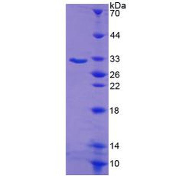 SGK1蛋白；血清/糖皮质激素调节激酶1(SGK1)重组蛋白