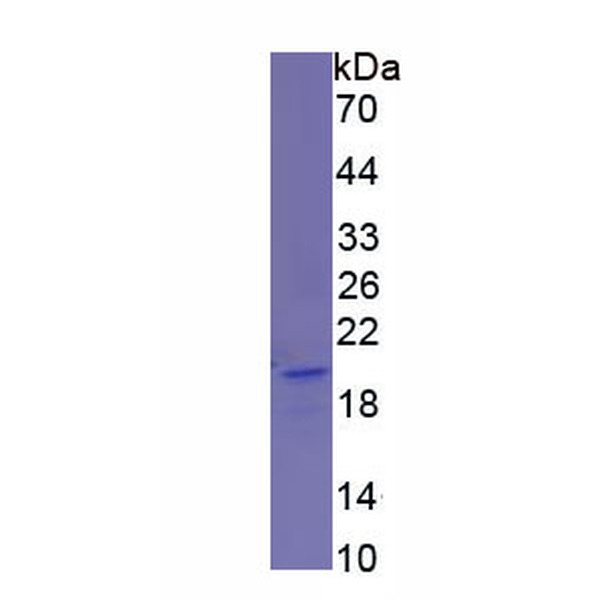 SIGLEC14蛋白；唾液酸结合Ig样凝集素14(SIGLEC14)重组蛋白
