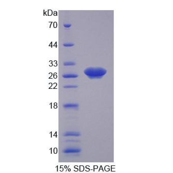 CDK16蛋白；周期素依赖性激酶16(CDK16)重组蛋白