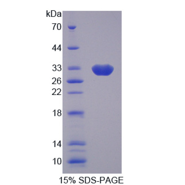 CIDEC蛋白；细胞死亡诱导DFFA样效应蛋白C(CIDEC)重组蛋白
