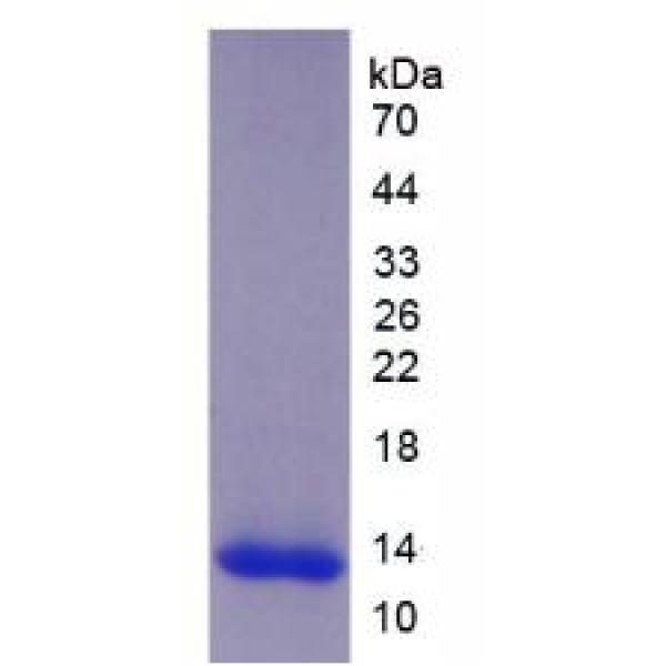 血小板反应蛋白解整合素金属肽酶8(ADAMTS8)重组蛋白