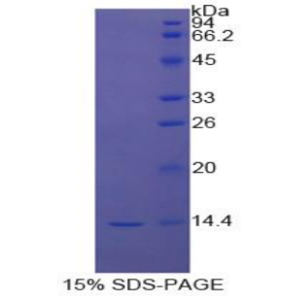 STAT3蛋白；信号传导转录激活因子3(STAT3)重组蛋白